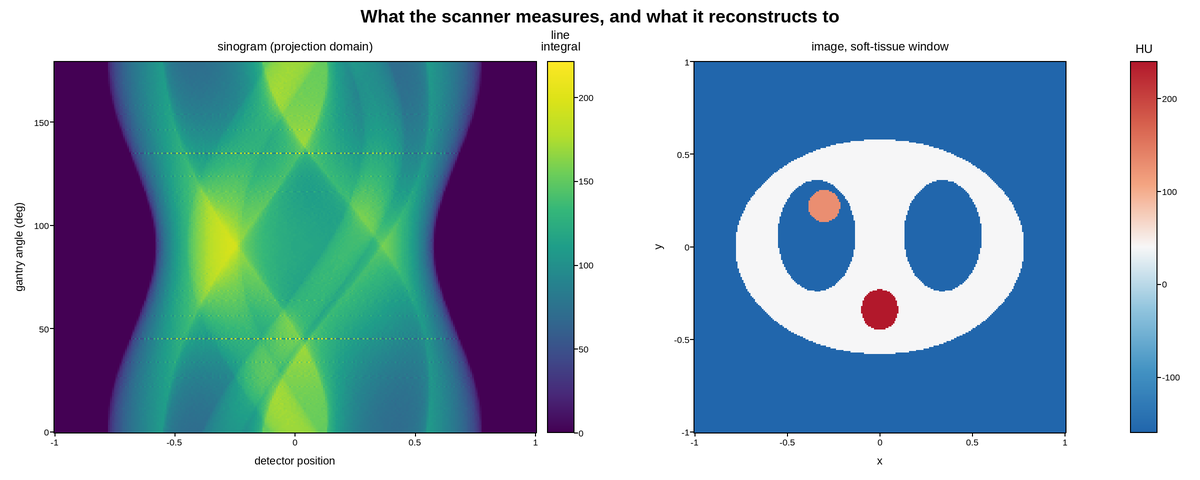 plot 02 ct sinogram