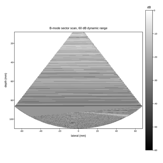 plot 03 ultrasound bmode