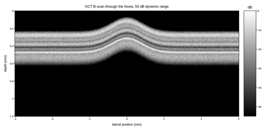 plot 04 oct retina