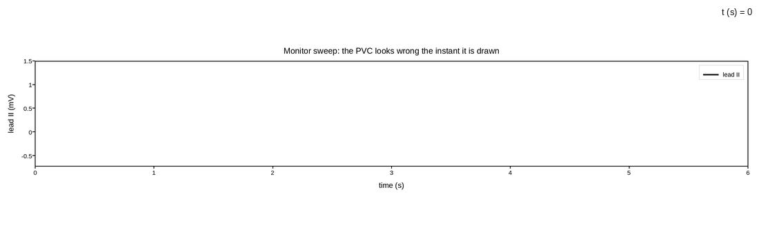 plot 10 ecg monitor sweep